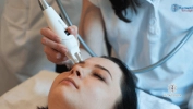 endermolift-górna-powieka2-sm